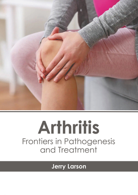 Arthritis: Frontiers in Pathogenesis and Treatment Cover Image