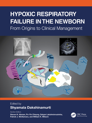 Hypoxic Respiratory Failure in the Newborn: From Origins to Clinical Management Cover Image