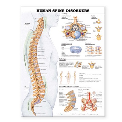 Human Spine Disorders Anatomical Chart Cover Image
