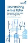 Understanding Venous Reflux the Cause of Varicose Veins and Venous Leg Ulcers: Varicose veins and venous leg ulcers (College of Phlebology) By Mark S. Whiteley Cover Image