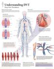 Understanding Dvt Chart: Laminated Wall Chart Cover Image