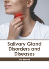 Salivary Gland Disorders and Diseases By Eric Brooks (Editor) Cover Image