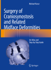 Surgery of Craniosynostosis and Related Midface Deformities: An Atlas and Step-By-Step Guide By Michael Rasse Cover Image