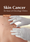 Skin Cancer: An Issue of Oncology Clinics Cover Image