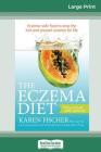 The Eczema Diet (2nd edition): Eczema-Safe Food to Stop The Itch and Prevent Eczema for Life (16pt Large Print Edition) By Karen Fischer Cover Image