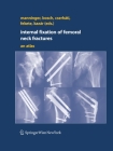 Internal Fixation of Femoral Neck Fractures: An Atlas Cover Image