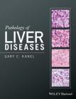 Pathology of Liver Diseases Cover Image