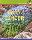 Skin Cancer (Health Alert) Cover Image