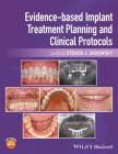 Evidence-Based Implant Treatment Planning and Clinical Protocols By Steven J. Sadowsky (Editor) Cover Image
