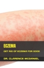 Eczema: Get Rid of Eczema for Good Cover Image