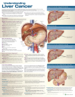Understanding Liver Cancer Anatomical Chart Cover Image