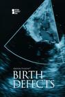 Birth Defects (Opposing Viewpoints) Cover Image