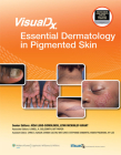 VisualDx: Essential Dermatology in Pigmented Skin (VisualDx: The Modern Library of Visual Medicine) Cover Image