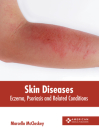 Skin Diseases: Eczema, Psoriasis and Related Conditions By Marcello McCloskey (Editor) Cover Image