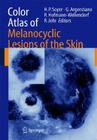 Color Atlas of Melanocytic Lesions of the Skin Cover Image