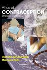 Atlas of Contraception Cover Image