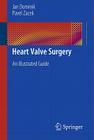 Heart Valve Surgery: An Illustrated Guide Cover Image