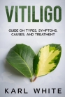 Vitiligo: Guide on Types, Symptoms, Causes, and Treatment By Karl White Cover Image