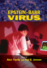 Epstein-Barr Virus (Infectious Disease and Therapy #38) Cover Image