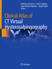 Clinical Atlas of CT Virtual Hysterosalpingography By Patricia Carrascosa (Editor), Carlos Capuñay (Editor), Juan Mariano Baronio (Editor) Cover Image