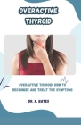 Overactive Thyroid: Overactive Thyroid: How to Recognize and Treat the Symptoms Cover Image