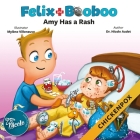 Amy Has a Rash: Chickenpox By Mylène Villeneuve (Illustrator), Nicole Audet Cover Image