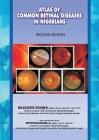 The Atlas of Retinal Diseases in Nigerians Cover Image