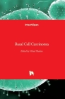 Basal Cell Carcinoma By Vishal Madan (Editor) Cover Image