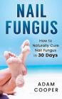 Nail Fungus: How to Naturally Cure Nail Fungus in 30 Days: Natural remedies, homeopathy for toenail fungus Cover Image