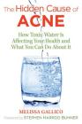 The Hidden Cause of Acne: How Toxic Water Is Affecting Your Health and What You Can Do about It Cover Image
