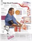 High Blood Pressure Chart: Wall Chart By Scientific Publishing (Other) Cover Image