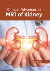 Clinical Advances in MRI of Kidney By Eliza Harris (Editor) Cover Image