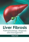 Liver Fibrosis: Pathophysiology, Diagnosis and Management By Finley Bush (Editor) Cover Image