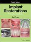 Implant Restorations: A Step-By-Step Guide By Carl Drago Cover Image