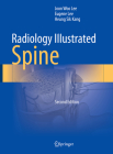 Radiology Illustrated: Spine Cover Image