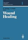 Fibrin Sealing in Surgical and Nonsurgical Fields: Volume 1: Wound Healing Cover Image