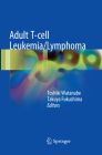 Adult T-Cell Leukemia/Lymphoma By Toshiki Watanabe (Editor), Takuya Fukushima (Editor) Cover Image