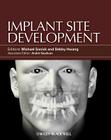 Implant Site Development By Michael Sonick (Editor), Debby Hwang (Editor) Cover Image