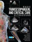 Basic Transesophageal and Critical Care Ultrasound Cover Image