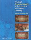 Practical Osseous Surgery in Periodontics and Implant Dentistry By Serge Dibart, Jean-Pierre Dibart Cover Image