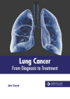 Lung Cancer: From Diagnosis to Treatment By Jute Cassie (Editor) Cover Image