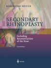 Secondary Rhinoplasty: Including Reconstruction of the Nose Cover Image