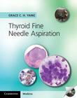 Thyroid Fine Needle Aspiration with CD Extra Cover Image