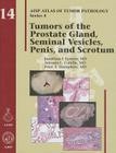 Tumors of the Prostate Gland, Seminal Vesicles, Penis, and Scrotum (AFIP Atlas of Tumor Pathology: Series 4) By Jonathan I. Epstein Cover Image