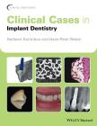 Clinical Cases in Implant Dentistry (Clinical Cases (Dentistry)) By Nadeem Karimbux (Editor), Hans-Peter Weber (Editor) Cover Image
