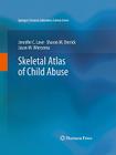 Skeletal Atlas of Child Abuse (Springer's Forensic Laboratory Science) By Jennifer C. Love, Sharon M. Derrick, Jason M. Wiersema Cover Image