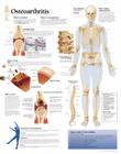 Understanding Osteoarthritis Chart: Laminated Wall Chart Cover Image