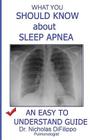 What You Should Know about Sleep Apnea: An Easy to Understand Guide By Nicholas Difilippo Cover Image