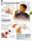 Understanding Asthma Chart: Wall Chart Cover Image