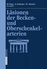 Läsionen Der Becken- Und Oberschenkelarterien Cover Image